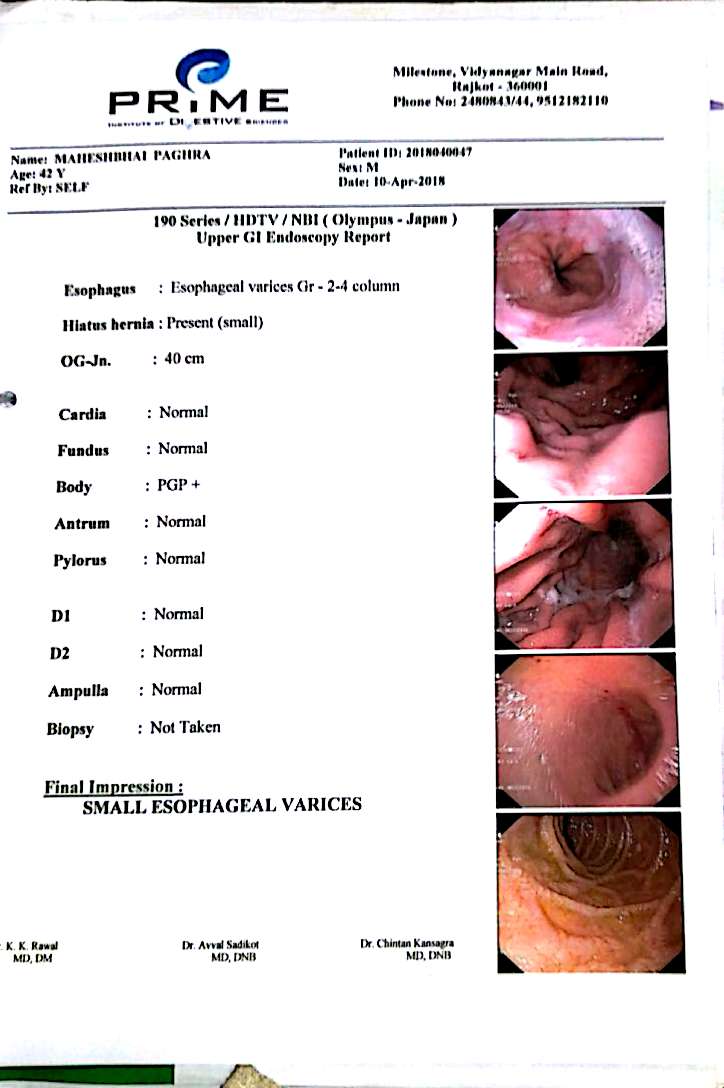 7 UGI Scopy – Ayurbhav | Ayurved And Panchkarma Hospital